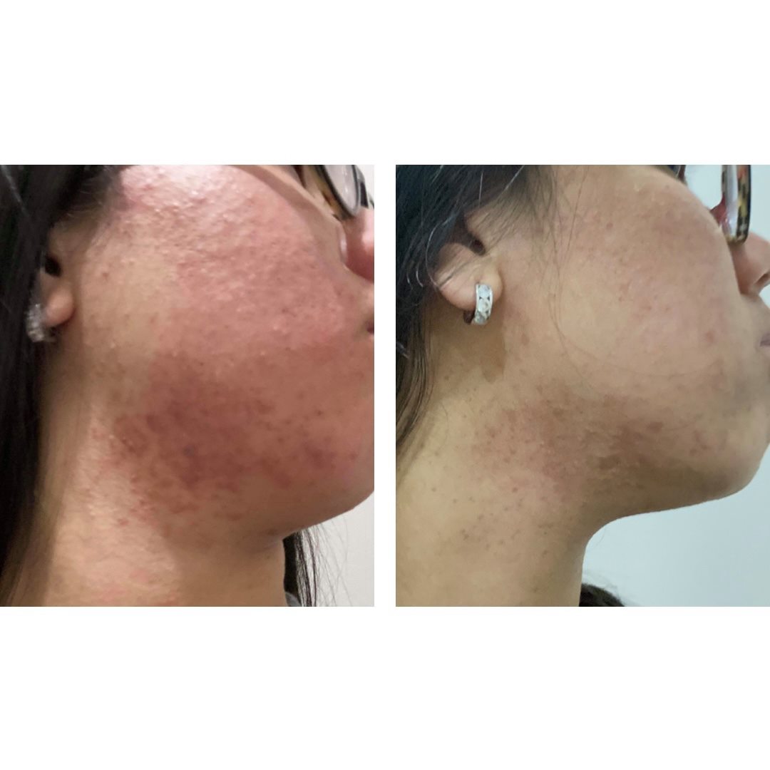 Serum & Moisturiser